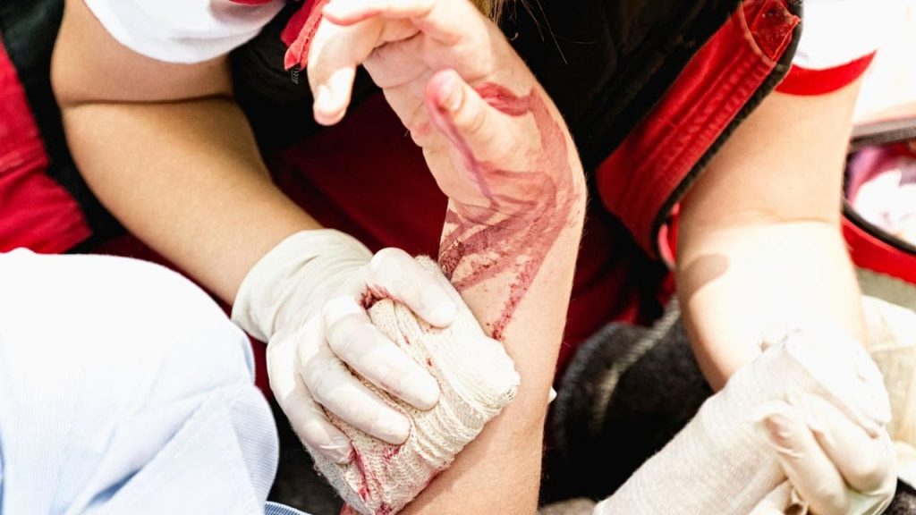 A paramedic carefully cleaning blood from an injured hand after an accident