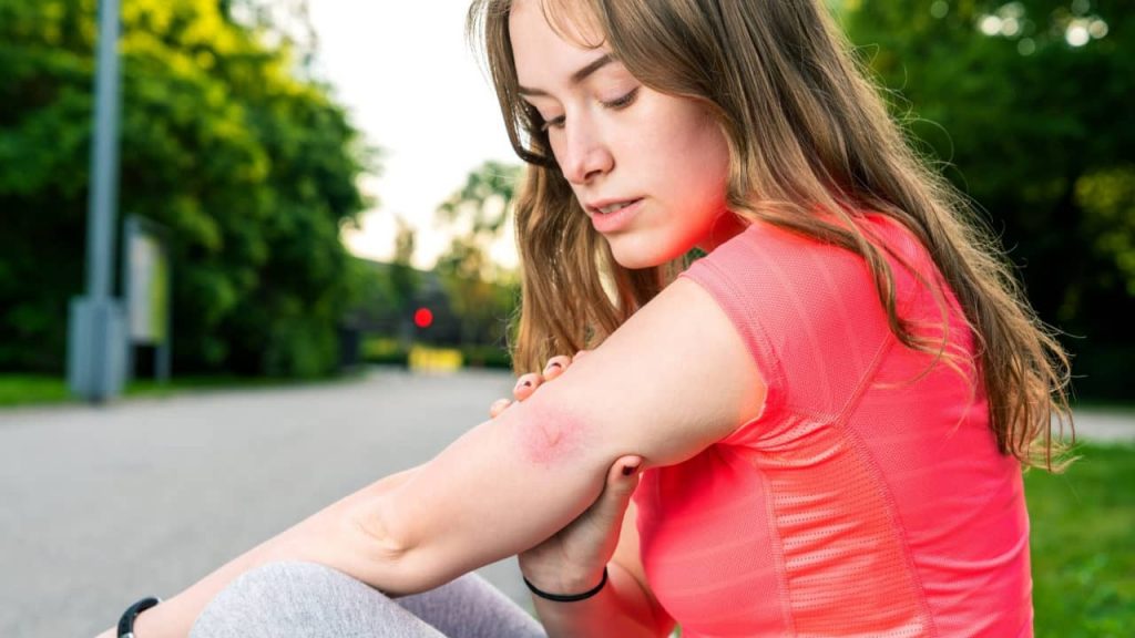 Woman with a scrape on her shoulder