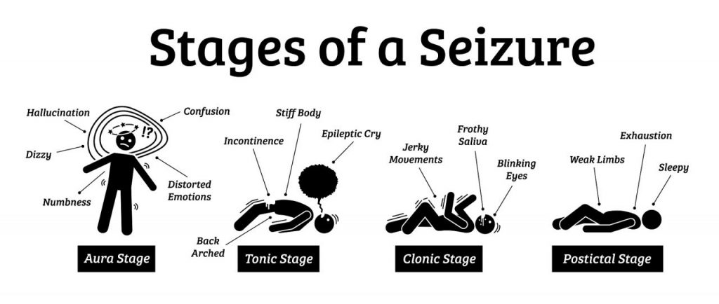 Chiropractic and grand mal seizures