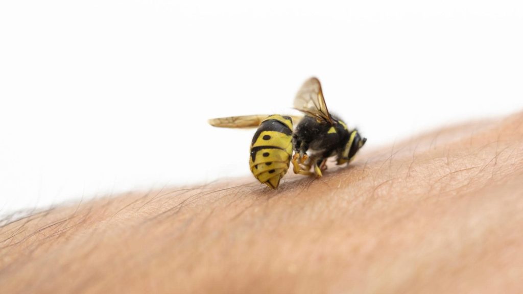 What To Do When Stung By A Bee | Coast2Coast