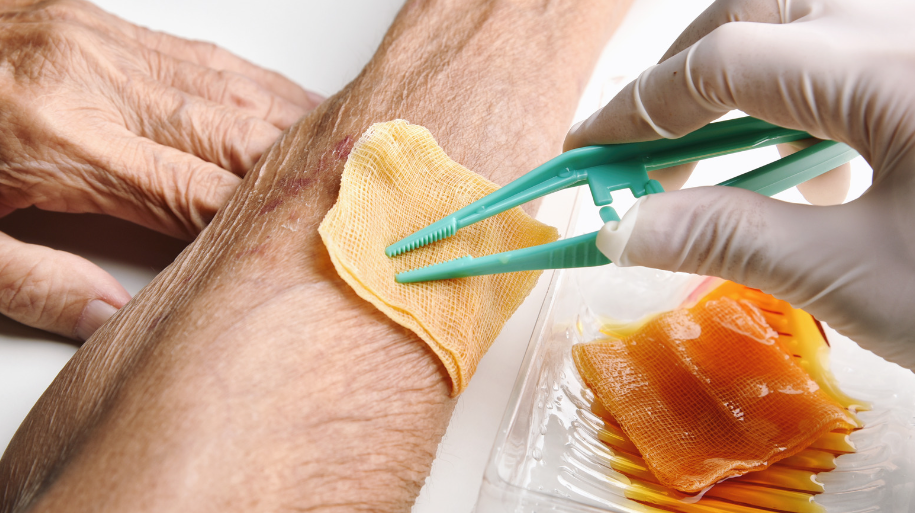 Wound Care Basics include identifying the different types of wounds, cleaning and dressing them accordingly.