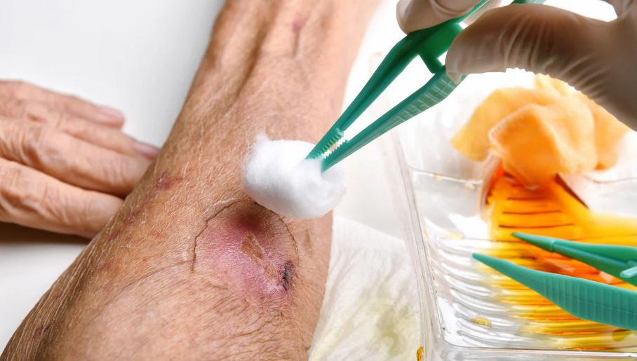 Wound care basics include cleaning the wound before dressing it.