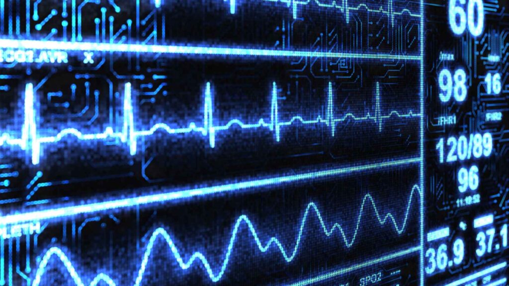 Hospital monitor with cardiac metrics